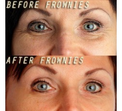 Under Eye Gels